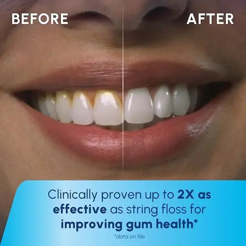 Waterpik Cordless Rechargeable Water Flosser for Teeth & Gums â€?ADA Accepted, Waterproof, 2 Tips, Blue