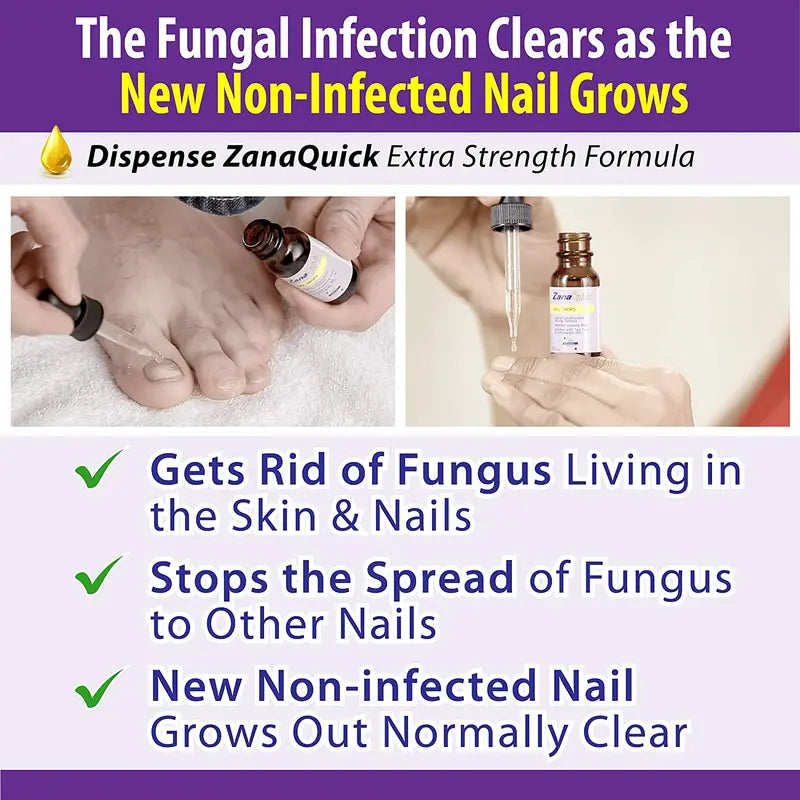 ZanaQuick Toenail Fungus Treatment Drops â€?2 Pack â€?Nail Fungus Treatment For Toenail Remedy, Powerful Nail Fungus Treatment For Fingernail & Toenail